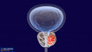 O que é a Próstata?